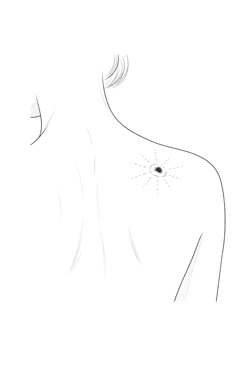 Dermatology medical illustration