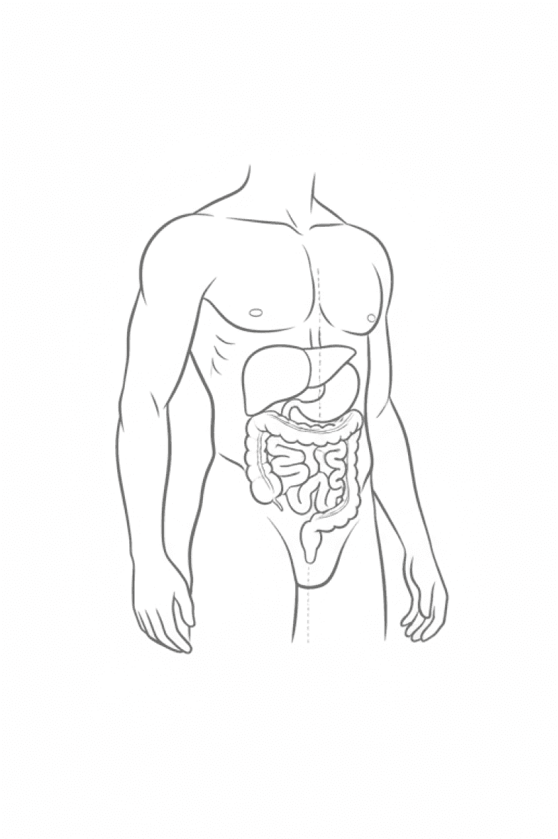 General surgery medical illustration